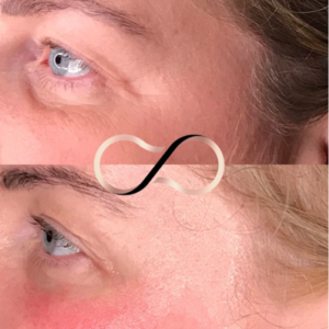 Facial Cosmetic Perfection Wirral Aesthetic Clinic