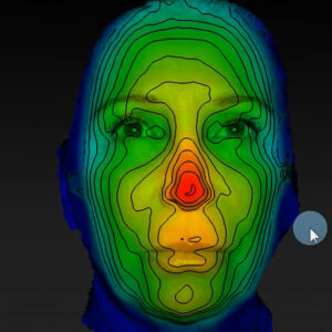 LifeViz Mini Skin Analysis Wirral Merseyside Cosmetic Perfection